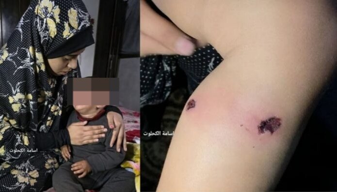 ಇಸ್ರೇಲಿ ವಿಷಜಂತುಗಳ ಅಟ್ಟಹಾಸ; ಗಾಝಾದಲ್ಲಿ ಮಗುವಿಗೆ ಸಿಗರೇಟ್‌ನಿಂದ ಸುಟ್ಟು, ಮೊಳೆ ಚುಚ್ಚಿ ಚಿತ್ರಹಿಂಸೆ ಕೊಟ್ಟ ಇಸ್ರೇಲಿ ರಕ್ಷಸರು